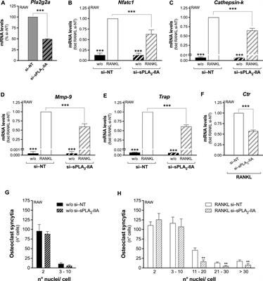 Multimodal regulation of the osteoclastogenesis process by secreted group IIA phospholipase A2